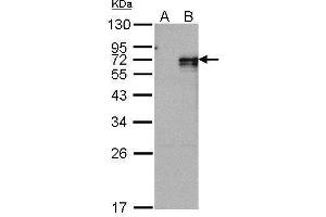 WB Image Western Blot analysis of NR4A1 expression in transfected 293T cell line by NR4A1 polyclonal antibody. (NR4A1 抗体  (C-Term))