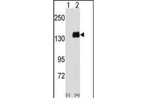 Western blot analysis of PUM1 (arrow) using PUM1 Antibody (Y83) (ABIN391822 and ABIN2841668). (PUM1 抗体  (AA 62-91))