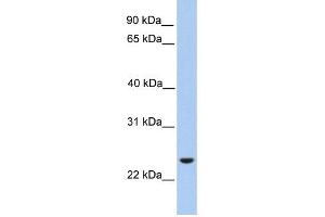 ORAI1 antibody used at 1 ug/ml to detect target protein. (ORAI1 抗体  (Middle Region))