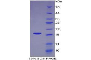 SDS-PAGE (SDS) image for Ferritin, Mitochondrial (FTMT) (AA 54-229) protein (His tag) (ABIN2121023)