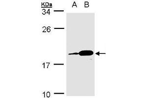 WB Image Sample(30 ug whole cell lysate) A:MOLT4 , B:Raji , 15% SDS PAGE antibody diluted at 1:1000 (MZB1 抗体)