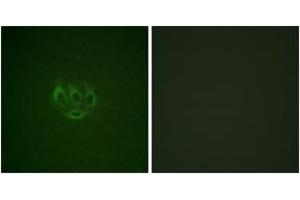 Immunofluorescence (IF) image for anti-tyrosine Kinase, Non-Receptor, 2 (TNK2) (AA 250-299), (pTyr284) antibody (ABIN1531417)