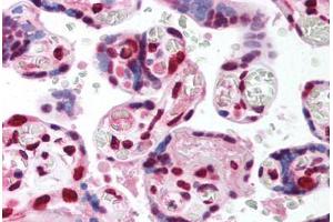 Human Placenta (formalin-fixed, paraffin-embedded) stained with TCF4 antibody ABIN214151 at 5 ug/ml followed by biotinylated goat anti-rabbit IgG secondary antibody ABIN481713, alkaline phosphatase-streptavidin and chromogen. (TCF4 抗体  (AA 73-122))