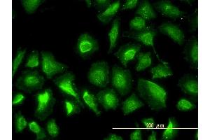 Immunofluorescence of monoclonal antibody to PGM1 on HeLa cell.