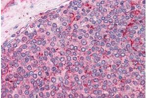 Human Spleen: Formalin-Fixed, Paraffin-Embedded (FFPE)