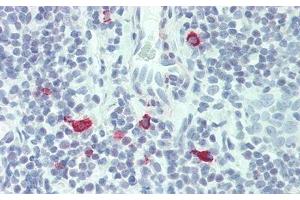 Detection of IL3 in Human Tonsil Tissue using Polyclonal Antibody to Interleukin 3 (IL3) (IL-3 抗体  (AA 20-152))