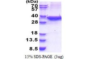 SDS-PAGE (SDS) image for Sirtuin 5 (SIRT5) (AA 34-310) protein (His tag) (ABIN5853379) (SIRT5 Protein (AA 34-310) (His tag))