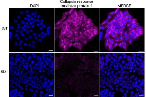 anti-Collapsin Response Mediator Protein 1 (CRMP1) antibody