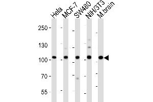 Western blot analysis of lysates from Hela, MCF-7, S, mouse NIH/3T3 cell line, mouse brain tissue lysate (from left to right), using EPHA4 Antibody (Center) (ABIN6243785 and ABIN6577670). (EPH Receptor A4 抗体  (AA 383-417))
