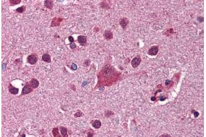 Human Brain, Cortex: Formalin-Fixed, Paraffin-Embedded (FFPE) (FKBP5 抗体  (AA 326-375))