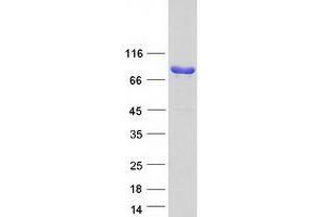 Western Blotting (WB) image for Scinderin (SCIN) (Transcript Variant 2) protein (Myc-DYKDDDDK Tag) (ABIN2731481)