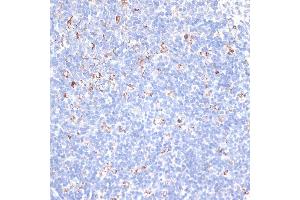 Immunohistochemistry of paraffin-embedded mouse spleen using KCNS3 antibody (ABIN6132153, ABIN6142774, ABIN6142775 and ABIN6223897) at dilution of 1:100 (40x lens). (KCNS3 抗体  (AA 1-180))