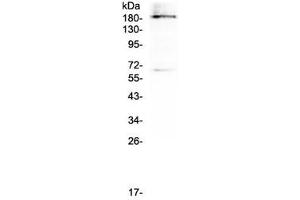 Western blot testing of human U937 cell lysate with Dnmt1 antibody at 0. (DNMT1 抗体)