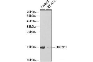 Western blot analysis of extracts of various cell lines using UBE2D1 Polyclonal Antibody at dilution of 1:1000. (UBE2D1 抗体)