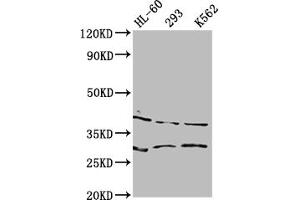 Western Blot Positive WB detected in: HL60 whole cell lysate, 293 whole cell lysate, K562 whole cell lysate All lanes: DMRT1 antibody at 1:2000 Secondary Goat polyclonal to rabbit IgG at 1/50000 dilution Predicted band size: 40, 29, 19 kDa Observed band size: 40 kDa (DMRT1 抗体  (AA 195-363))
