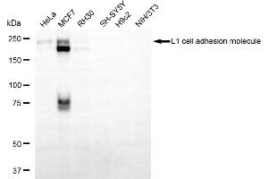 Western blotting analysis using L1 cell adhesion molecule antibody (ABIN7799217). (L1CAM 抗体)