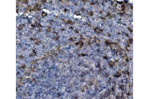 IHC analysis of SELPLG using anti-SELPLG antibody (ABIN7600337). (SELPLG 抗体  (AA 18-397))