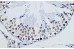 Immunohistochemistry of paraffin-embedded Rat testis using DiMethyl-Histone H4-K20 Polyclonal Antibody at dilution of 1:200 (40x lens). (Histone H4 抗体  (2meLys20))