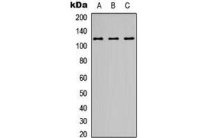 Western blot analysis of NMDAR1 expression in A549 (A), Y79 (B), Raji (C) whole cell lysates. (GRIN1/NMDAR1 抗体  (C-Term))