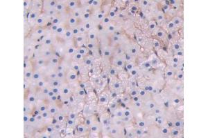 Immunohistochemistry (IHC) image for anti-ATP-Binding Cassette, Sub-Family D (Ald), Member 1 (ABCD1) (AA 102-386) antibody (ABIN5013194)