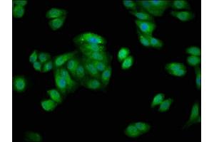 Immunofluorescence staining of HepG2 cells with ABIN7154867 at 1:66, counter-stained with DAPI. (HSP70 1A 抗体  (AA 418-512))