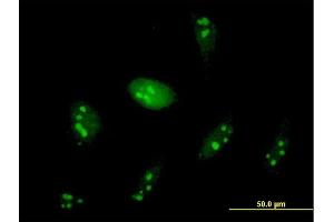 Immunofluorescence of purified MaxPab antibody to WDR74 on HeLa cell. (WDR74 抗体  (AA 1-366))