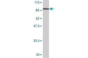 Western Blotting (WB) image for anti-Insulin-Like Growth Factor 2 mRNA Binding Protein 3 (IGF2BP3) (AA 1-579) antibody (ABIN524077)