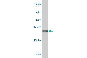 Western Blot detection against Immunogen (33. (MAGEA3 抗体  (AA 44-114))