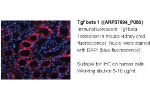 Image no. 2 for anti-Transforming Growth Factor, beta 1 (TGFB1) (Middle Region) antibody (ABIN2780306) (TGFB1 抗体  (Middle Region))