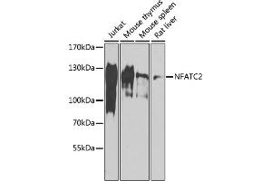 Western blot analysis of extracts of various cell lines, using NF antibody (ABIN6130583, ABIN6144556, ABIN6144557 and ABIN6218469) at 1:1000 dilution. (NFAT1 抗体  (AA 1-300))