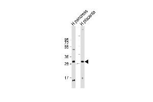 All lanes : Anti-P1R3E Antibody (Center) at 1:2000 dilution Lane 1: human pancreas lysate Lane 2: human placenta lysate Lysates/proteins at 20 μg per lane. (PPP1R3E 抗体  (AA 159-192))