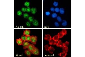 (ABIN185607) Immunofluorescence analysis of paraformaldehyde fixed Jurkat cells, permeabilized with 0.