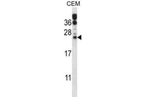 Western Blotting (WB) image for anti-RAB6B, Member RAS Oncogene Family (RAB6B) antibody (ABIN2997576)