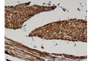 Immunoperoxidase of monoclonal antibody to FADS1 on formalin-fixed paraffin-embedded human skeletal muscle. (FADS1 抗体  (AA 1-99))