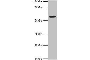 Western blot All lanes: STXBP4 antibody at 10 μg/mL + PC-3 whole cell lysate Secondary Goat polyclonal to rabbit IgG at 1/10000 dilution Predicted band size: 62, 27 kDa Observed band size: 62 kDa (STXBP4 抗体  (AA 344-553))