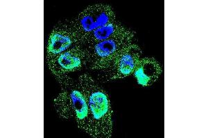 Confocal immunofluorescent analysis of TIMP1 Antibody (C-term) with A2058 cell followed by Alexa Fluor 488-conjugated goat anti-rabbit lgG (green). (TIMP1 抗体  (C-Term))