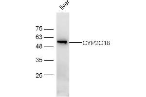 Mouse liver lysates probed with CYP2C18 Polyclonal Antibody, Unconjugated  at 1:300 dilution and 4˚C overnight incubation. (CYP2C18 抗体  (AA 401-490))