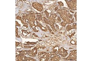 IHC analysis of SCO1 using anti-SCO1 antibody (ABIN7600609).