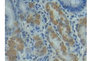 Detection of FASL in Human Stomach Tissue using Polyclonal Antibody to Factor Related Apoptosis Ligand (FASL)