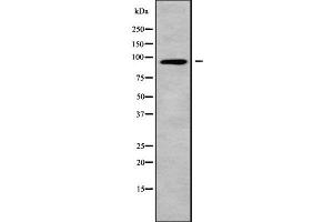 Western blot analysis of CNGB3 using A549 whole cell lysates (CNGB3 抗体  (N-Term))