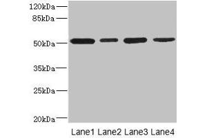 Western blot All lanes: CD276 antibody at 0. (CD276 抗体  (AA 29-200))