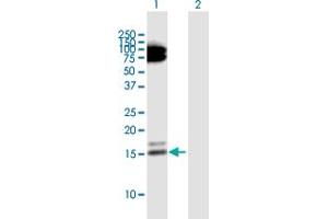 Western Blot analysis of RARRES2 expression in transfected 293T cell line by RARRES2 MaxPab polyclonal antibody. (Chemerin 抗体  (AA 1-163))