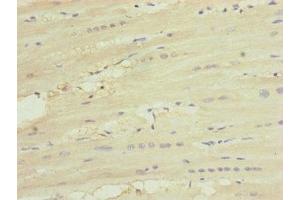 Immunohistochemistry of paraffin-embedded human heart tissue using ABIN7174236 at dilution of 1:100 (MNF1 抗体  (AA 14-126))