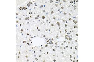Immunohistochemistry of paraffin-embedded mouse liver using HDAC3 antibody (ABIN6290462) at dilution of 1:100 (40x lens). (HDAC3 抗体)