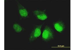 Immunofluorescence of monoclonal antibody to CASP14 on HeLa cell. (CASP14 抗体  (AA 133-242))