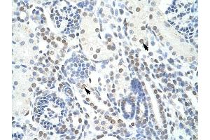 POGZ antibody was used for immunohistochemistry at a concentration of 4-8 ug/ml to stain EpitheliaI cells of renal tubule (arrows) in Human Kidney. (POGZ 抗体  (N-Term))