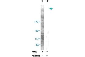 Western blot analysis of extracts from NIH/3T3 cells, treated with PMA (125 ng/ml, 30 mins), using ACACA polyclonal antibody . (Acetyl-CoA Carboxylase alpha 抗体  (Ser79))