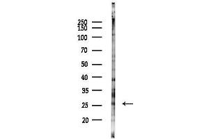 Western blot analysis of lysates from EC304 cells(heat-shock 45 min treatment), using SPC24 Antibody at 1/1000 dilution.