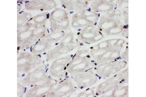 Anti-Apoptosis inhibitor 5 antibody, IHC(F) IHC(F): Rat Cardiac Muscle Tissue (Apoptosis Inhibitor 5 抗体  (C-Term))
