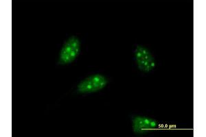Immunofluorescence (IF) image for anti-Pancreas Specific Transcription Factor, 1a (PTF1A) (AA 250-328) antibody (ABIN531479)